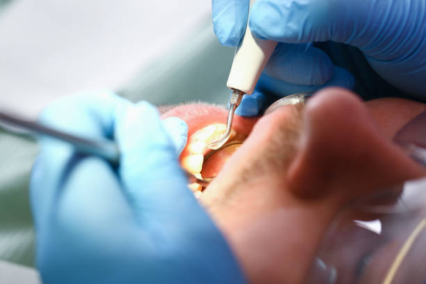 Best Tooth Infection Emergency Dentist  in Fabens, TX